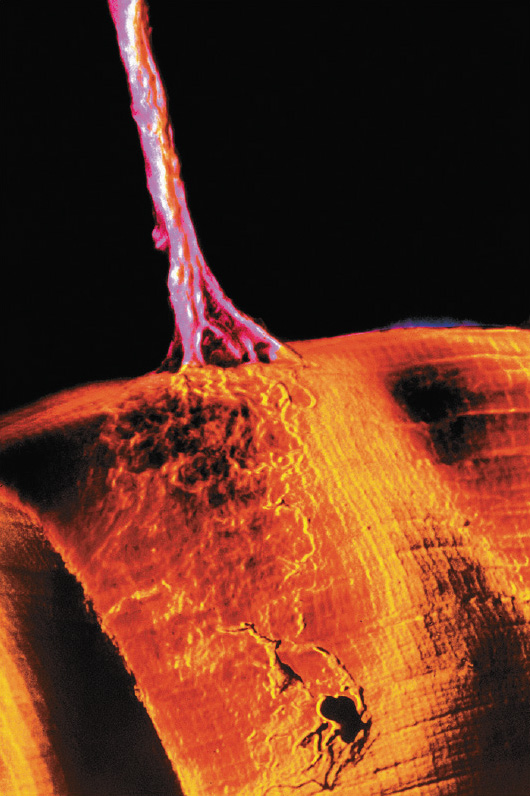A micrograph shows the neuron as a long, vertical fiber-like structure with branched tips that touch a curved sheet-like structure with striations.
